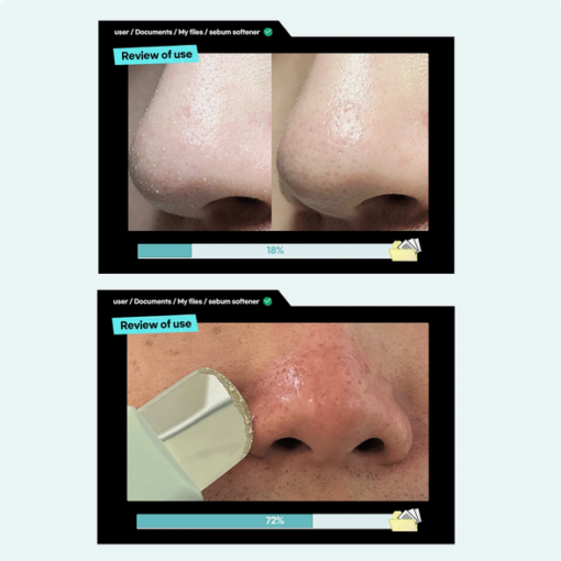 Super Melting Sebum Softener - Image 4